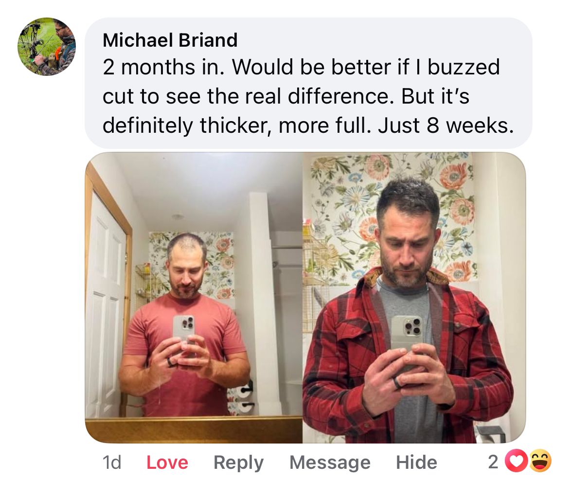 Copper Peptide Hair Regrowth Serum